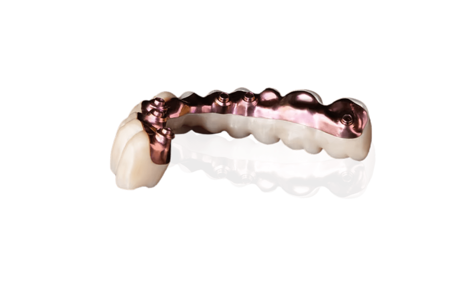 Prama Prama Dental Implant System Products - Multiple Prostheses for Screw-Retained Implants