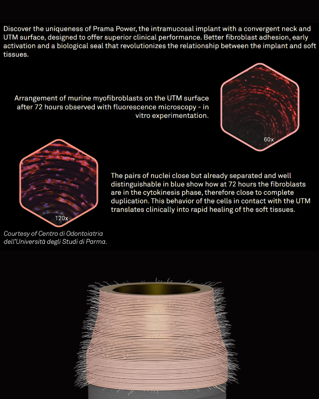 Prama Dental Implant System