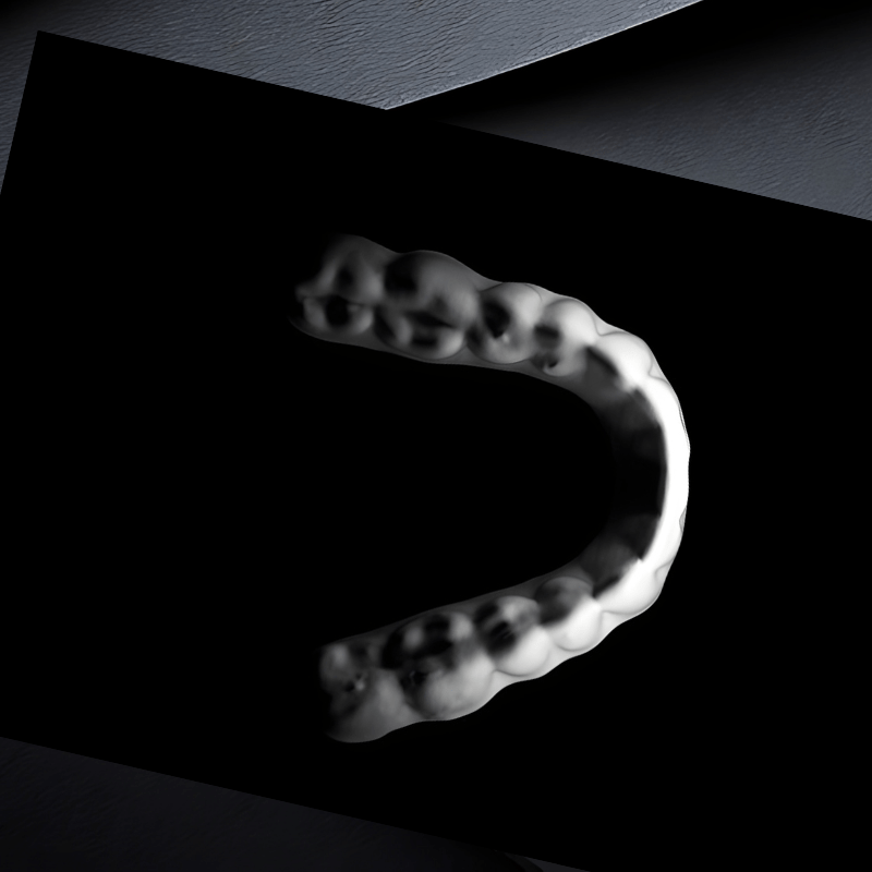 noxi night aligner system indonesia - ultra dent solution noxi night aligner system indonesia - ultra dent solution