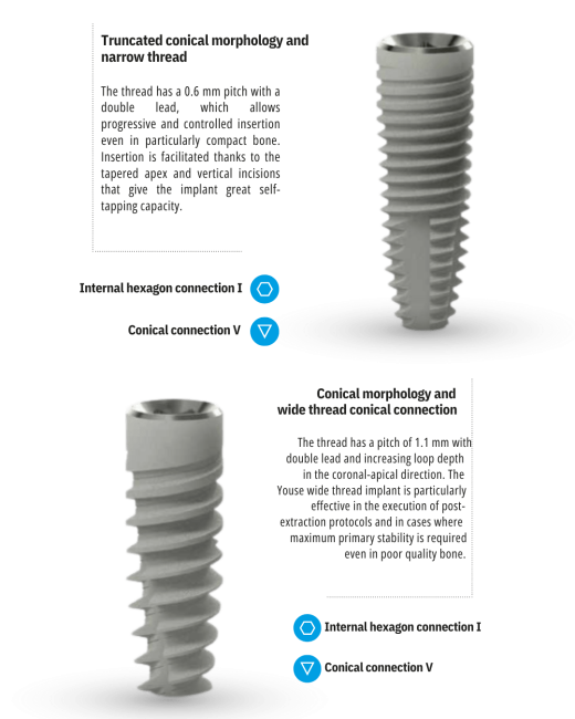youse sweden & martina implant abutment dental system indonesia singapore malaysia asia - ultra dent solution authorized distributor oral surgery system (1)